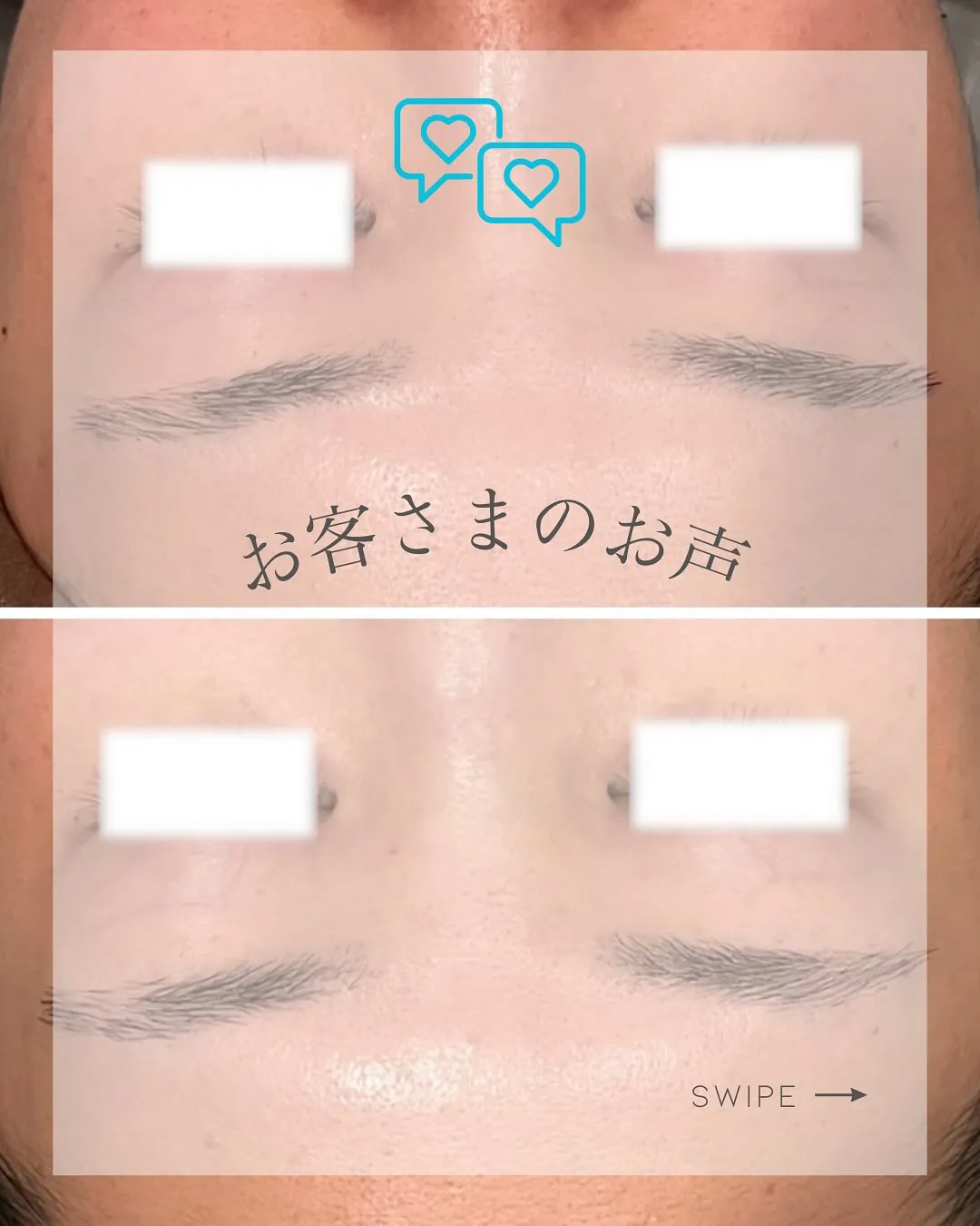 \肌がきめ細かくて、化粧水の入りが◎/