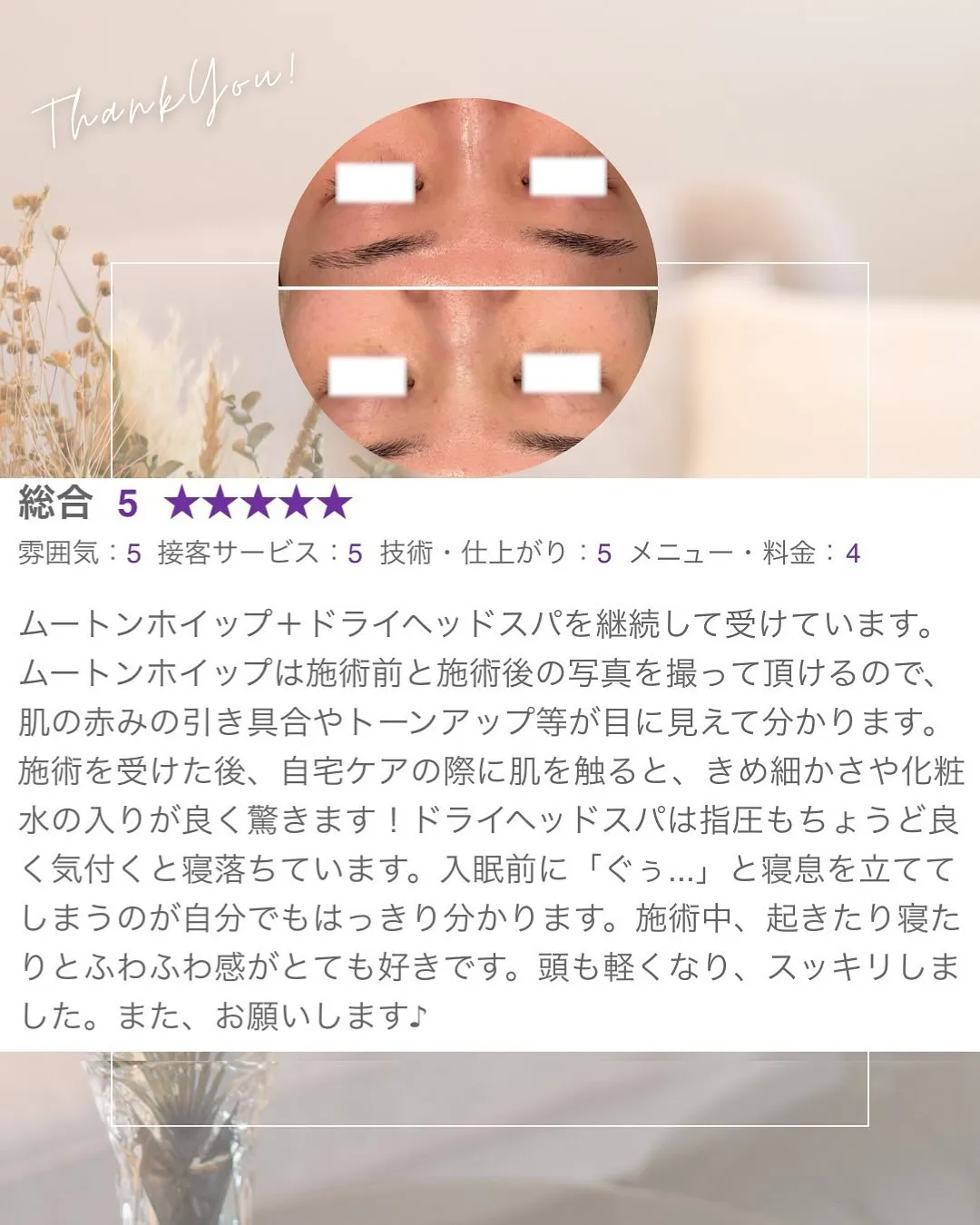 \肌がきめ細かくて、化粧水の入りが◎/